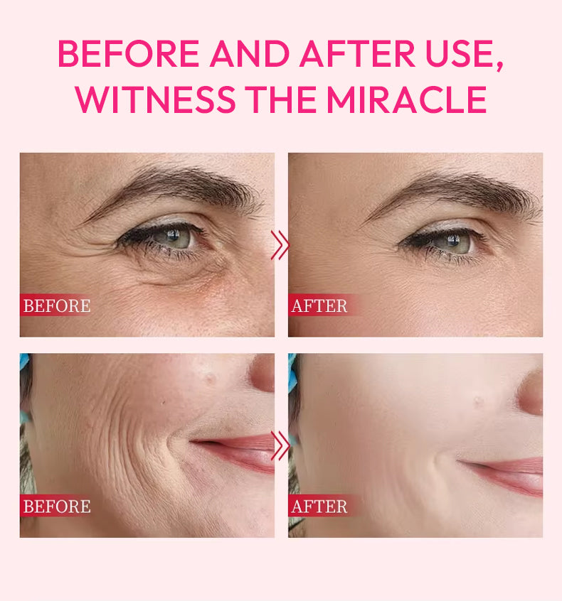 Custom OEM facial collagen skincare lifting serum, firming and moisturizing salmon DNA serum PDRN